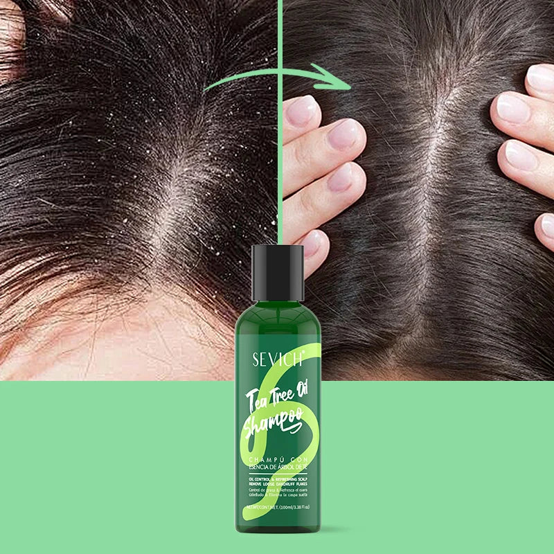 Tea Tree Essence Shampoo Hair Conditioner Set Deep Cleaning Moisturizing Scalp Strengthening Nourish Shiny Anti Hair Loss Care