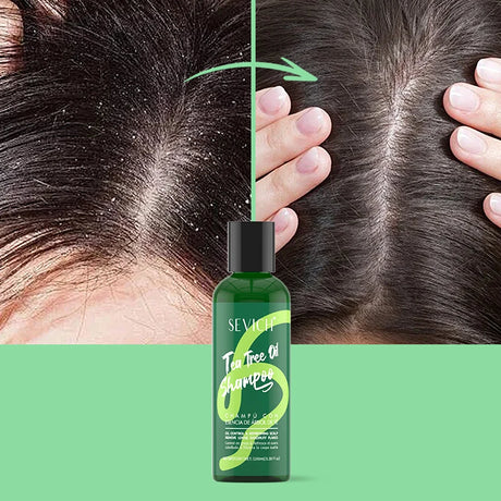 Tea Tree Essence Shampoo Hair Conditioner Set Deep Cleaning Moisturizing Scalp Strengthening Nourish Shiny Anti Hair Loss Care