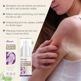 Ximonth Skin Soothing Spray Relieves Redness Itching Nourishes Moisturizes Soothes Skin Non Irritating Gentle Repair Skin Care