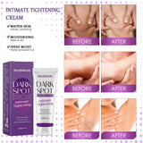 Body Whitening Lotion Dark Spot Remover For Underarms Knees Elbows Melanin Bleaching Lightening Skin Moisturizing Cream 60g