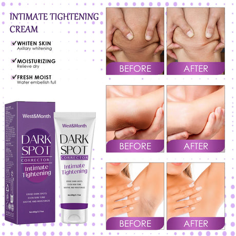 Body Whitening Lotion Dark Spot Remover For Underarms Knees Elbows Melanin Bleaching Lightening Skin Moisturizing Cream 60g