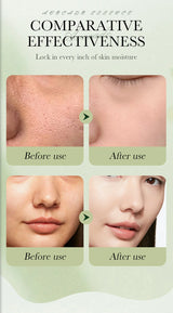 Avocado Skincare 6-Piece Set Includes Nourishing And Moisturizing Eye Cream, Face Cream, And Anti-Wrinkle Skincare Products.