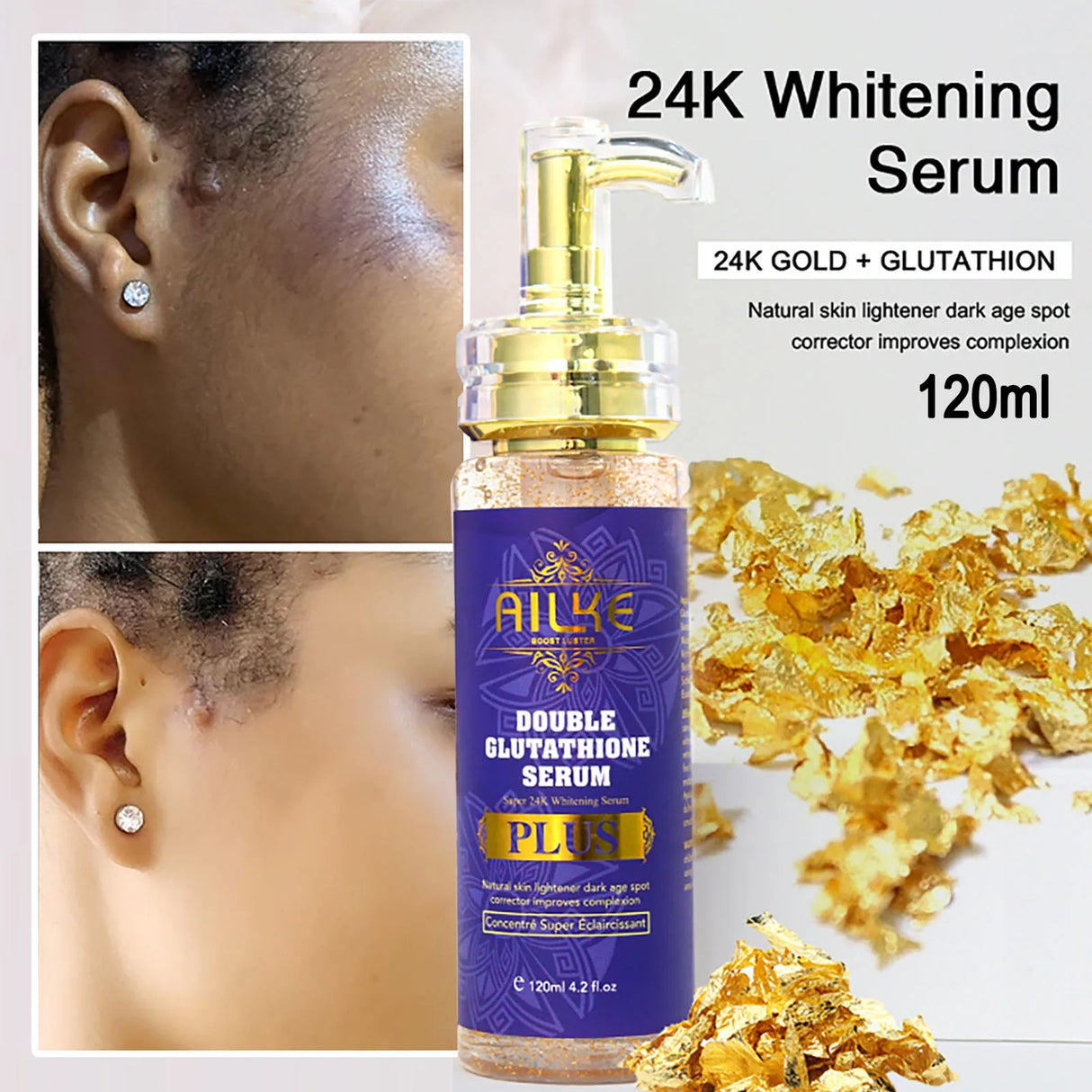 AILKE Body Milk For Brightening And Clearing Uneven Skin Tone, Moisturizes, Remove Black Spots, Whitening, For All Skin Types