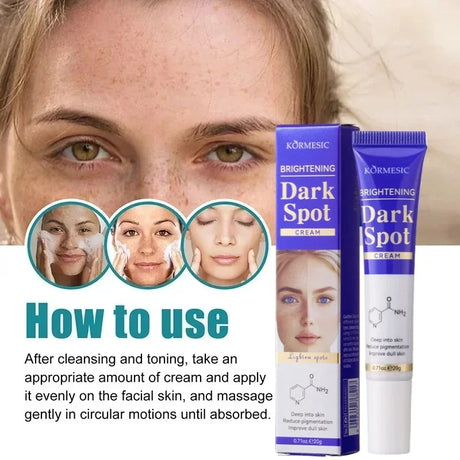 Dark Spots Removal Cream Facial Whitening Freckle Acne Mark Pigmentation Removal Melanin Skin Correction Brighten Care Products