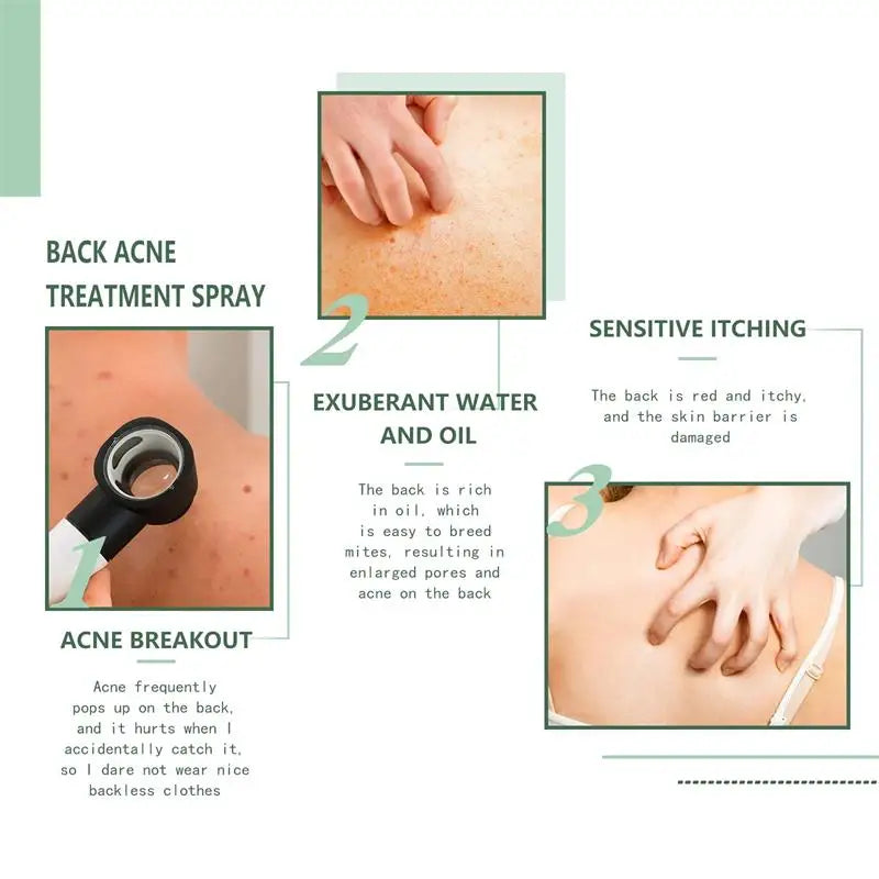 Keratosis Pilaris Repair Treatment Cream Exfoliating Removal Chicken Skin Cleaning Acne Spots Moisturizing Smooth Body Skin Care