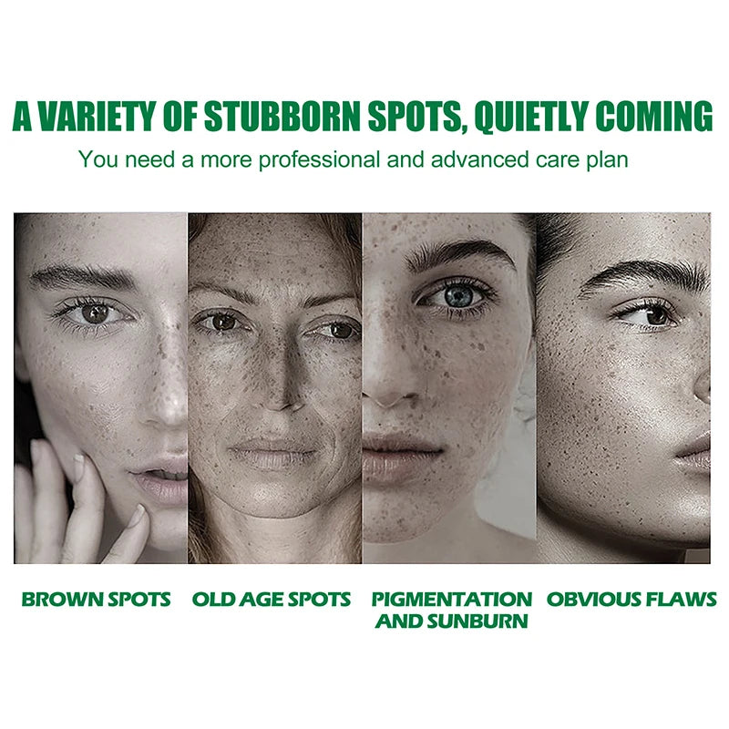 Dark Spot Correcting Glow Serum,Dullness,Acne,And Melanin Remover,Niacinamide Facial Skin Moisturizing Brightening Skincare