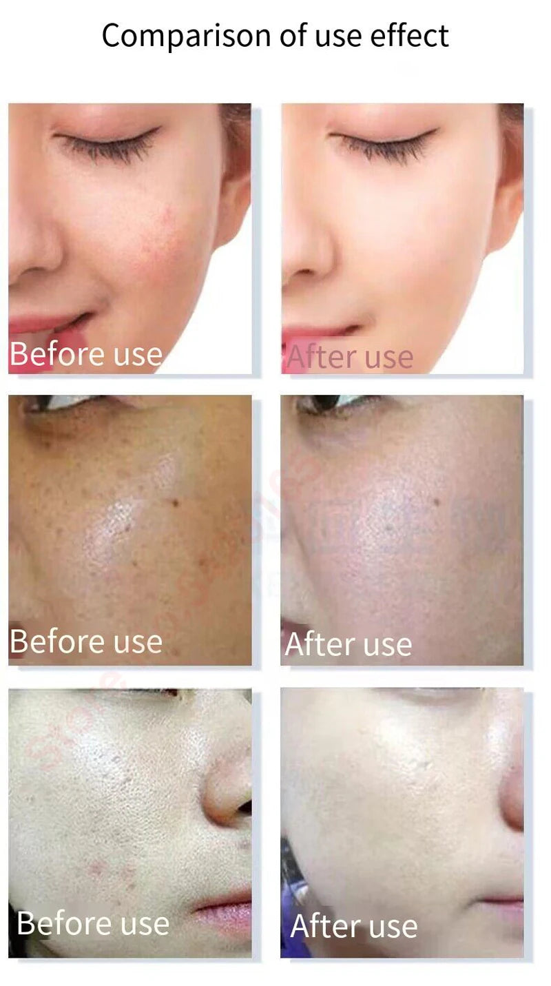 High Purity 98% Blue Copper Peptide Essence Facial Anti-Aging Repair Polypeptide Active Hyaluronic acid Moisturizing Skin Care