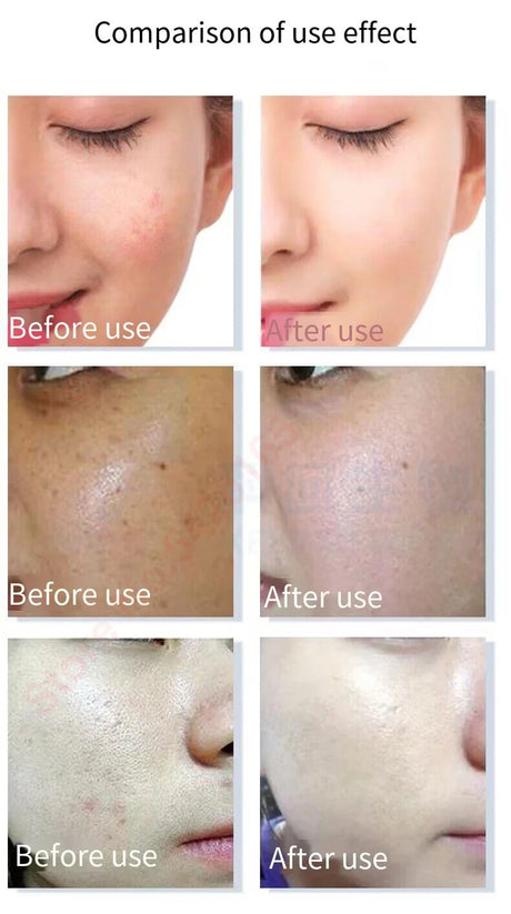 High Purity 98% Blue Copper Peptide Essence Facial Anti-Aging Repair Polypeptide Active Hyaluronic acid Moisturizing Skin Care