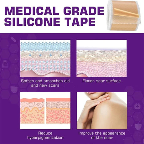 Silicone Scar Sheets - Reusable Scar Tape for Keloid, C-Section, Surgery, Burn, Acne - Waterproof, Hypoallergenic, Latex-Free