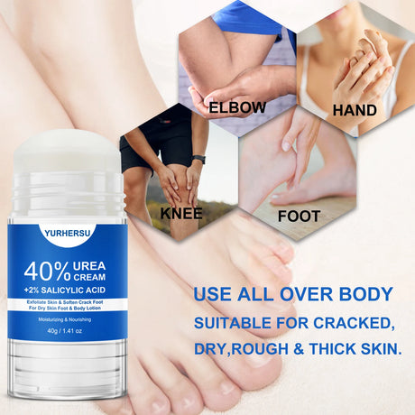 40% Urea Foot Cream Stick - Moisturizing & Exfoliating Cracked Heel Repair Deep Hydration for Dry Feet Long protect