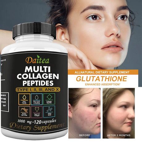 High Strength Multi-Collagen Complex Capsules – Hydrolyzed Peptides for Skin, Hair, Nails & Joints – Grass-Fed, Non-GMO