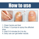 South Moon Foot Spray Anti Smell Remove Toenail Fungal Paronychia Onychomycosis Care Deodorant Antiperspirant Nail Repair Spray