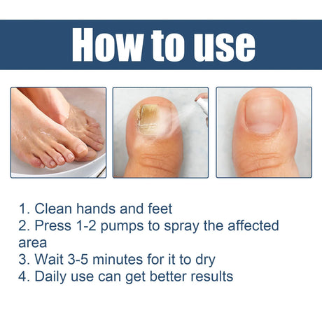 South Moon Foot Spray Anti Smell Remove Toenail Fungal Paronychia Onychomycosis Care Deodorant Antiperspirant Nail Repair Spray