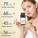 High Quality 50% Chemical Peel Acid Skin Superforce Pigmentation Lightening Melanin Acne Treatment Remove Scar