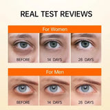 Anti Dark Circle Eye Serum Oil Retinol Anti Wrinkle Firming Lift Skin Remove Eyes Bag Fade Fine Line Whitening Brighten Eye Care