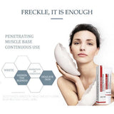 Whitening Freckle Cream Remove Dark Spots Anti Freckle Face Creams Niacinamide Fade Pigmentation Melasma Brighten Skin Care 20g