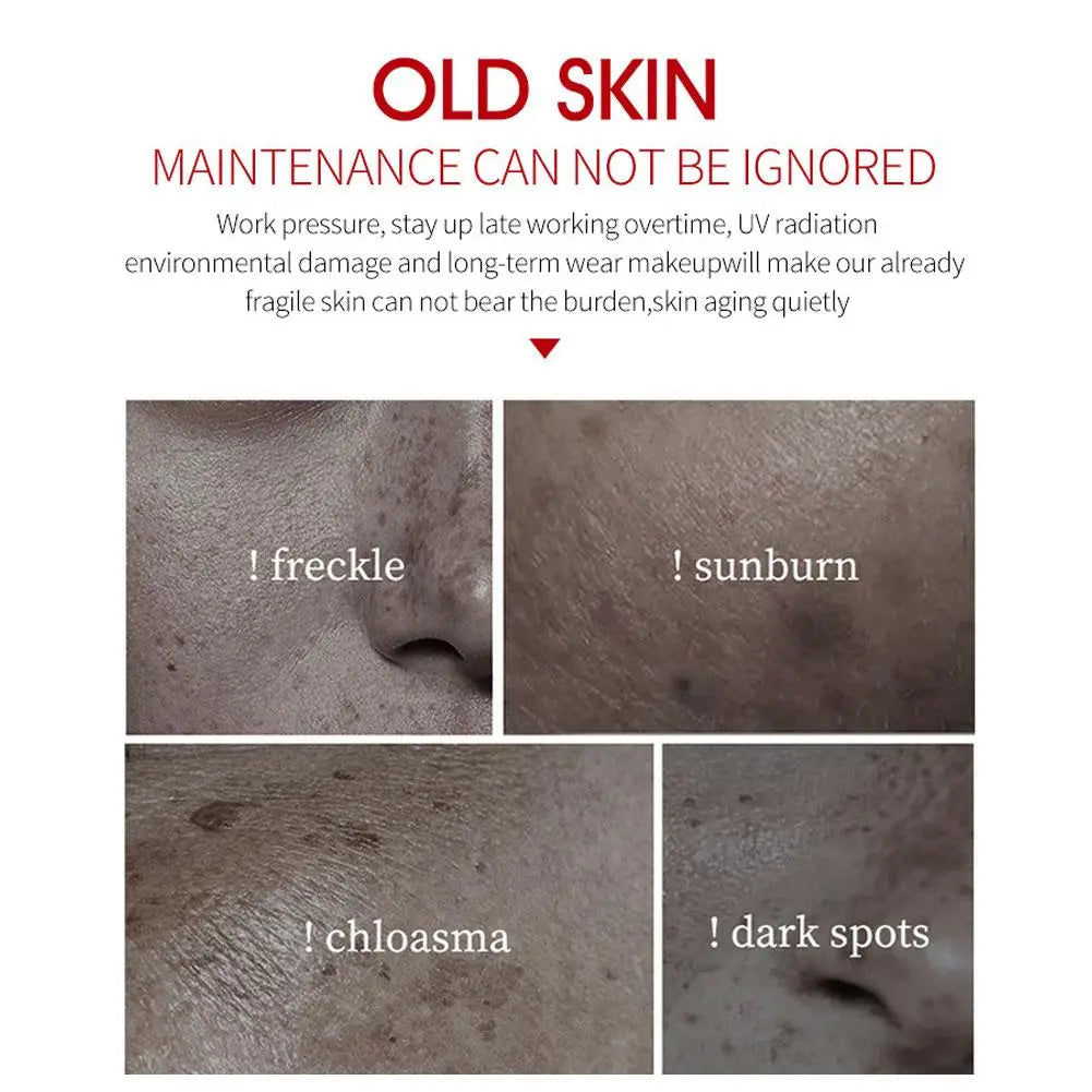 Face Cream Whitening Freckle Remove Facial Cream Remove The Black,Melasma Dark Spot Acne Deposits VE Nourish Brighten Skin Care