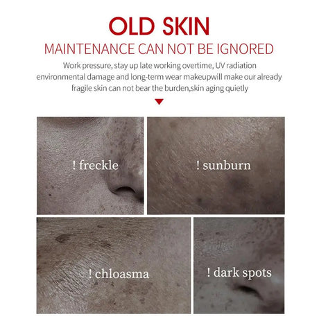 Face Cream Whitening Freckle Remove Facial Cream Remove The Black,Melasma Dark Spot Acne Deposits VE Nourish Brighten Skin Care