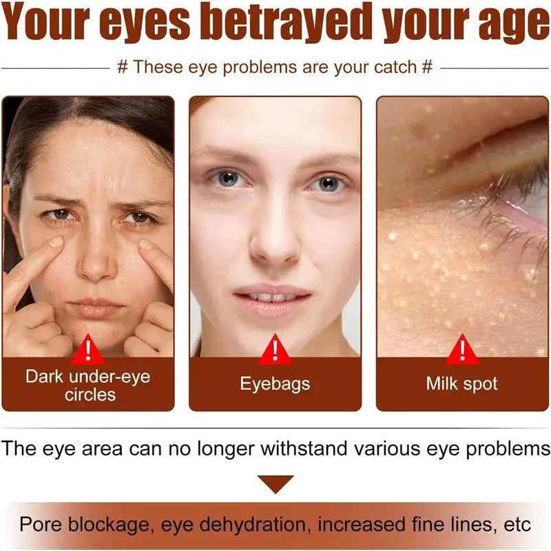 Fat Granules Remover Eye Cream Anti-Puffiness Anti Inflammatory Reduce Dark Circles Eyebags Fade Lines Moisturizing Eye Care