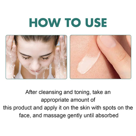 Whitening Freckle Cream Effectively reduces dark spots Brightens and revitalizes dull skin  Hydrates and nourishes the skin