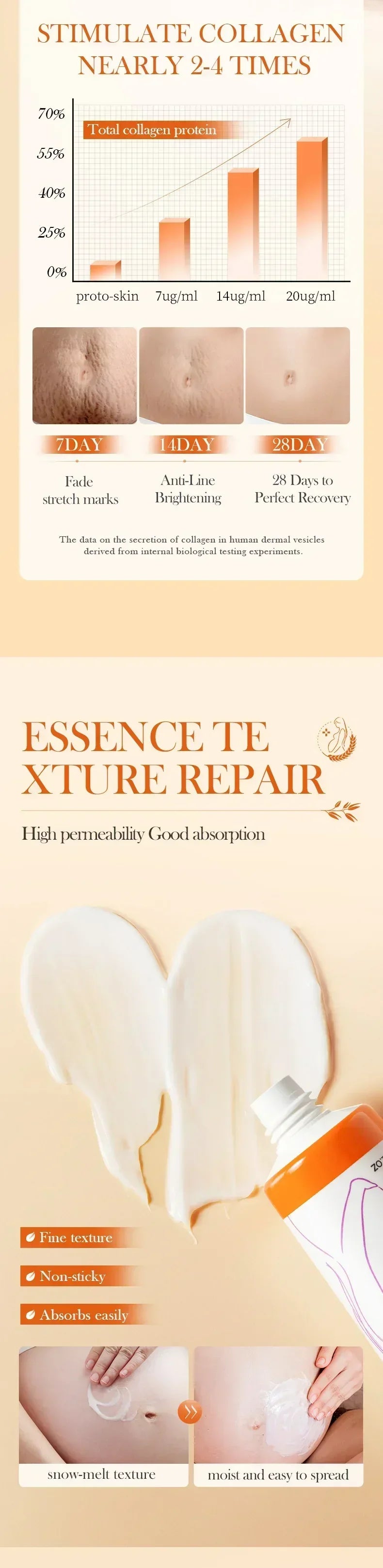 Cream For Pregnancy Stretch Marks Removal Eliminate Red White Old Stretch Marks  2025