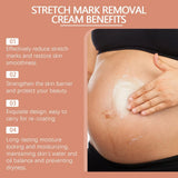 Cream For Pregnancy Stretch Marks Removal Eliminate Red White Old Stretch Marks  2025