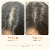 Hair Serum With Built-In Brush,Hair Nourishing Strengthening Essence,Improve Scalp Environment,Scalp Massager,Korean Hair Care