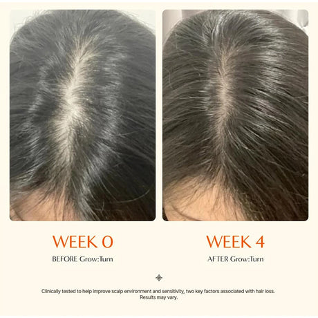 Hair Serum With Built-In Brush,Hair Nourishing Strengthening Essence,Improve Scalp Environment,Scalp Massager,Korean Hair Care