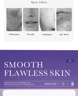SADOER Nicotinamide Remove Melasma Dark Spot Whiten Freckle Cream Lighten Melanin Brightens Skin Tone Moisturize Face Skin Care