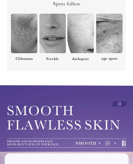SADOER Nicotinamide Remove Melasma Dark Spot Whiten Freckle Cream Lighten Melanin Brightens Skin Tone Moisturize Face Skin Care