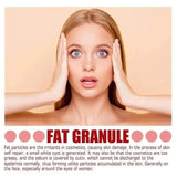 Fat Granules Remover Eye Cream Anti-Puffiness Anti Inflammatory Reduce Dark Circles Eyebags Fade Lines Moisturizing Eye Care