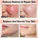 Facial Redness Repair Cream Improve Sensitive Skin Dryness Hydrating Sooth Lotion Removal Rosacea Day Night Korean Cosmetics