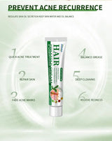 Anti-Acne Cream Effectively Removes Skin Nodules Pustules Cysts Papules Blackheads Men And Women Acne Skin Care Essence Cream