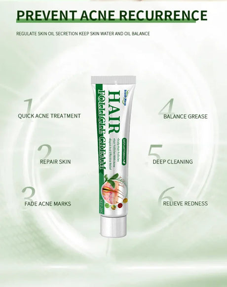Anti-Acne Cream Effectively Removes Skin Nodules Pustules Cysts Papules Blackheads Men And Women Acne Skin Care Essence Cream