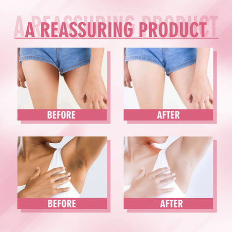 Body Whitening Cream Dark Spot Corrector for Underarms Knees Inner Thighs Brightening Moisturizing Intimate Area Lighten Lotion