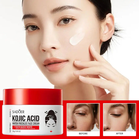 SADDER Kojic Acid Face Cream for Dark Spots Freckles Skin Care with Vitamin C, Whitening Treatment, Overnight Repair Moisturizer