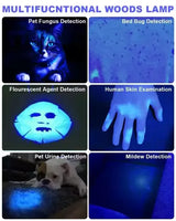 NEW Professional Dermatoscope Skin Medical Magnifier Detection Woods Lamp UVA Lamp For Vitiligo Detection