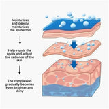 Powerful Spot-Removing Whiten Cream Brighten Skin Fast Eliminates Melanin Pigmentation Melasma Dark Spots Korean Face Skin Care