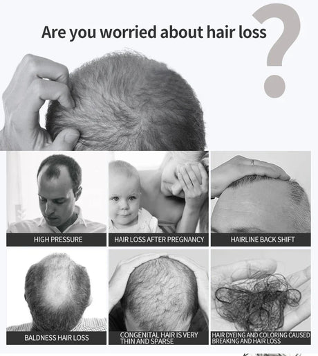 Hair Growth Serum 7 Days Fast Regrowth Essential Capsule Anti Hair Loss Baldness Repair Damaged Scalp Treatment For Women Men