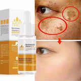 Dark Spots Remover Whitening Face Set Freckle Melanin Correcting Reduce Fine Lines Brighten Essence Korean Beauty Skin Care ﻿