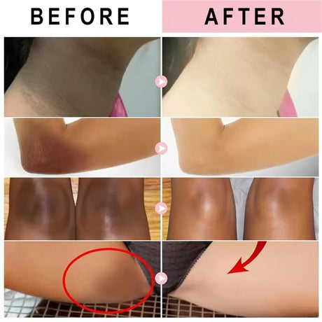 Glutathione Niacinamide Body Lotion Skin Brightening Hydrate Revitalize Even Skin Tone Whitening Face Bleaching Lightening Care