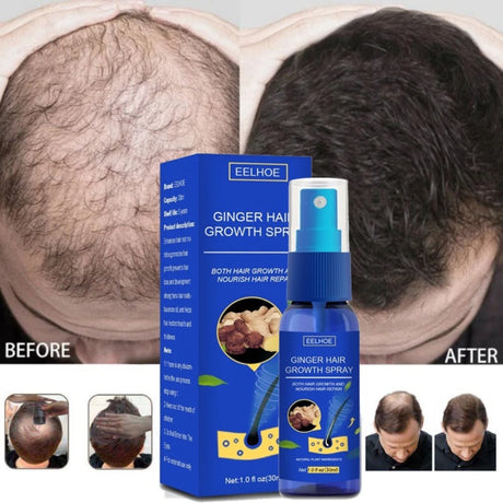Ginger Hair Growth spray Anti  Fall  Loss Treatment   Essence Oil for Men Women hair treatment
