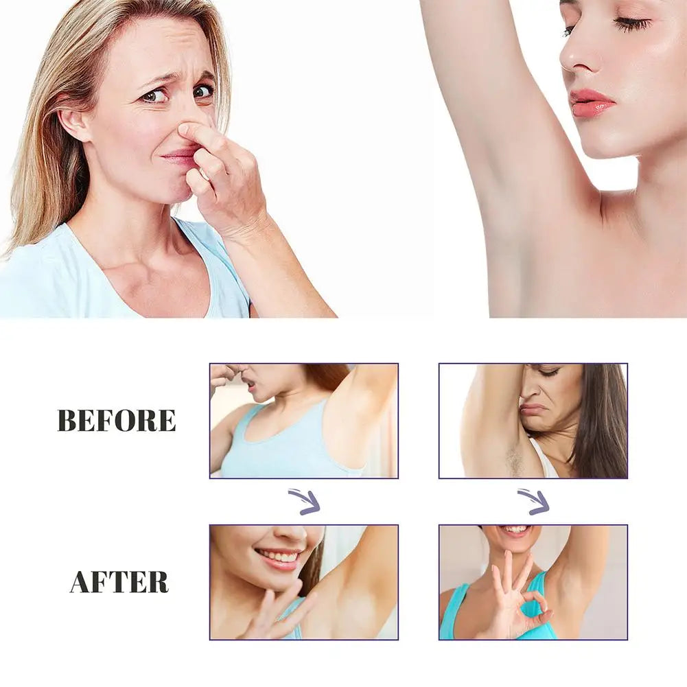 Underarm Whitening Cream Skin Smooth Lightening Cream Deodorant Serum For Underarm Body Intimate Area,Private Parts,Bikini Area