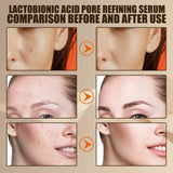 EELHOE Lactobionic Acid Pore Shrink Face Serum Skin Repair Remove Blackheads Acne Skin Care Lasting Moisturizing Korean Cosmetic