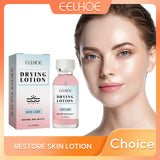 Salicylic Acid Facial Moisturizing Lotion Shrink Pores Nourishing Damaged Skin Treatment Acne Remove Spot Whitening Face Essence