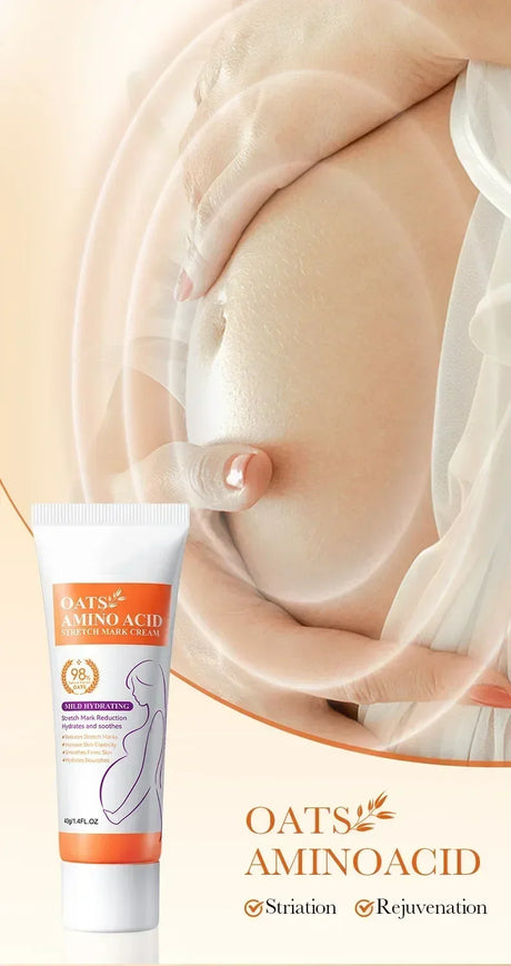 Cream For Pregnancy Stretch Marks Removal Eliminate Red White Old Stretch Marks  2025