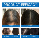 Roll-on Rosemary Hair Growth Serum Anti Hair Loss for Scalp Treatment Nourishing Strengthening Hair Roots Increases Hair Density