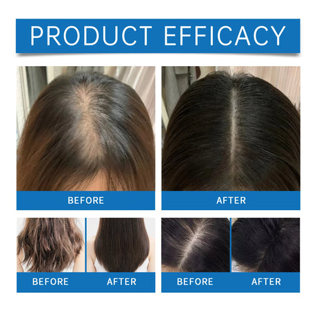 Roll-on Rosemary Hair Growth Serum Anti Hair Loss for Scalp Treatment Nourishing Strengthening Hair Roots Increases Hair Density