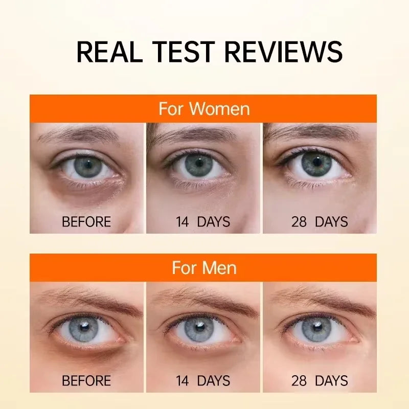 Anti Dark Circle Eye Serum Oil Retinol Anti Wrinkle Firming Lift Skin Remove Eyes Bag Fade Fine Line Whitening Brighten Eye Care