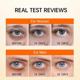 Anti Dark Circle Eye Serum Oil Retinol Anti Wrinkle Firming Lift Skin Remove Eyes Bag Fade Fine Line Whitening Brighten Eye Care